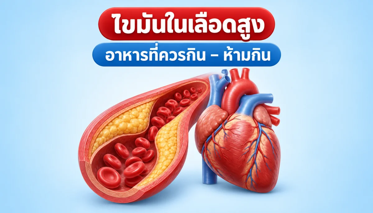 ภาพ 3D หลอดเลือดที่มีคราบไขมันสะสมข้างหัวใจ ภาวะไขมันในเลือดสูง